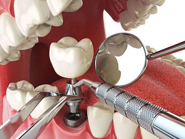 Best Emergency Treatment for Jaw Pain or Injury in Canton, PA